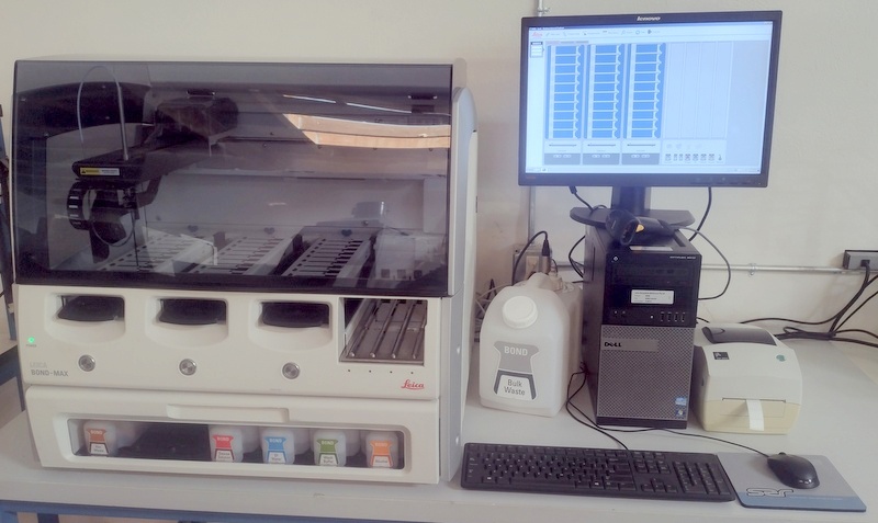 BOND-MAX IHC and ISH Automated Staining System